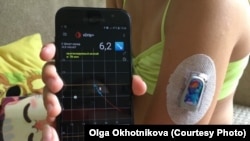 Алина Охотникова с сенсором Dexcom